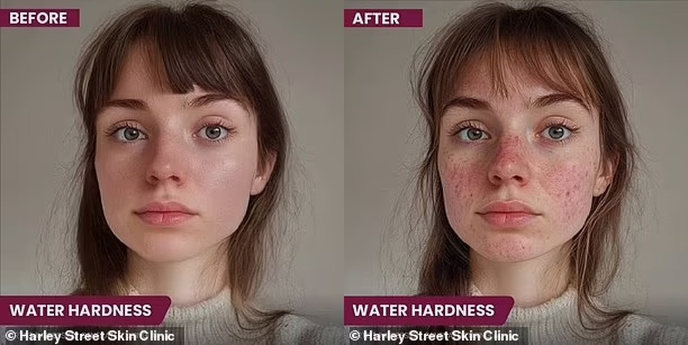 Água com muitos minerais causa ressecamento e danos — Foto: Reprodução