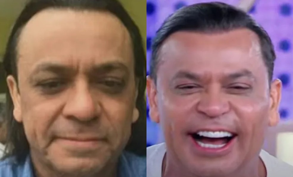 Harmonização facial: antes e depois de Frank Aguiar — Foto: Reprodução SBT