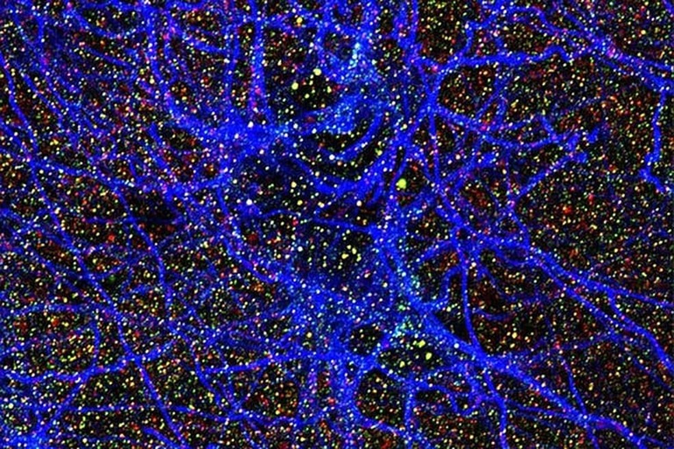Teia azul gigante representa uma célula cerebral chamada astrócito — Foto: Charles Zachary Klein, Raquel Taddei, Teresa Gomez-Isla, Hospital Geral de Massachusetts