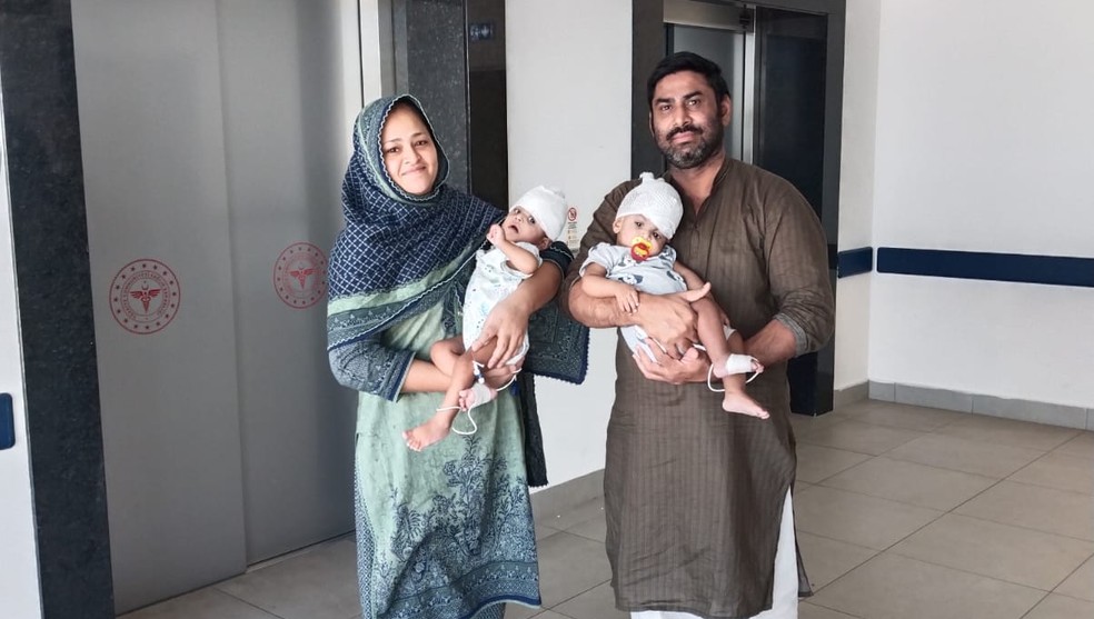 Opera&ccedil;&atilde;o, realizada no Hospital Municipal de Ankara Bilkent, na Turquia, durou 14 horas &mdash; Foto: Reprodu&ccedil;&atilde;o / Gemini Untwined