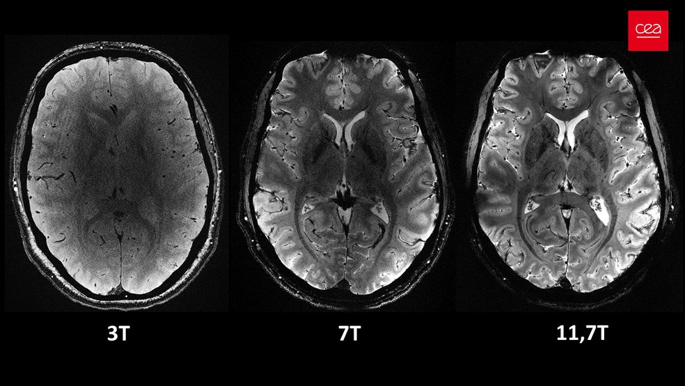 Vista axial do cérebro humano, com o mesmo tempo de aquisição, mas com diferentes intensidades de campo magnético. Na última, a imagem do Iseult Magneton 11.7 T MRI. — Foto: Divulgação / Comissão de Energia Atômica da França (CEA)