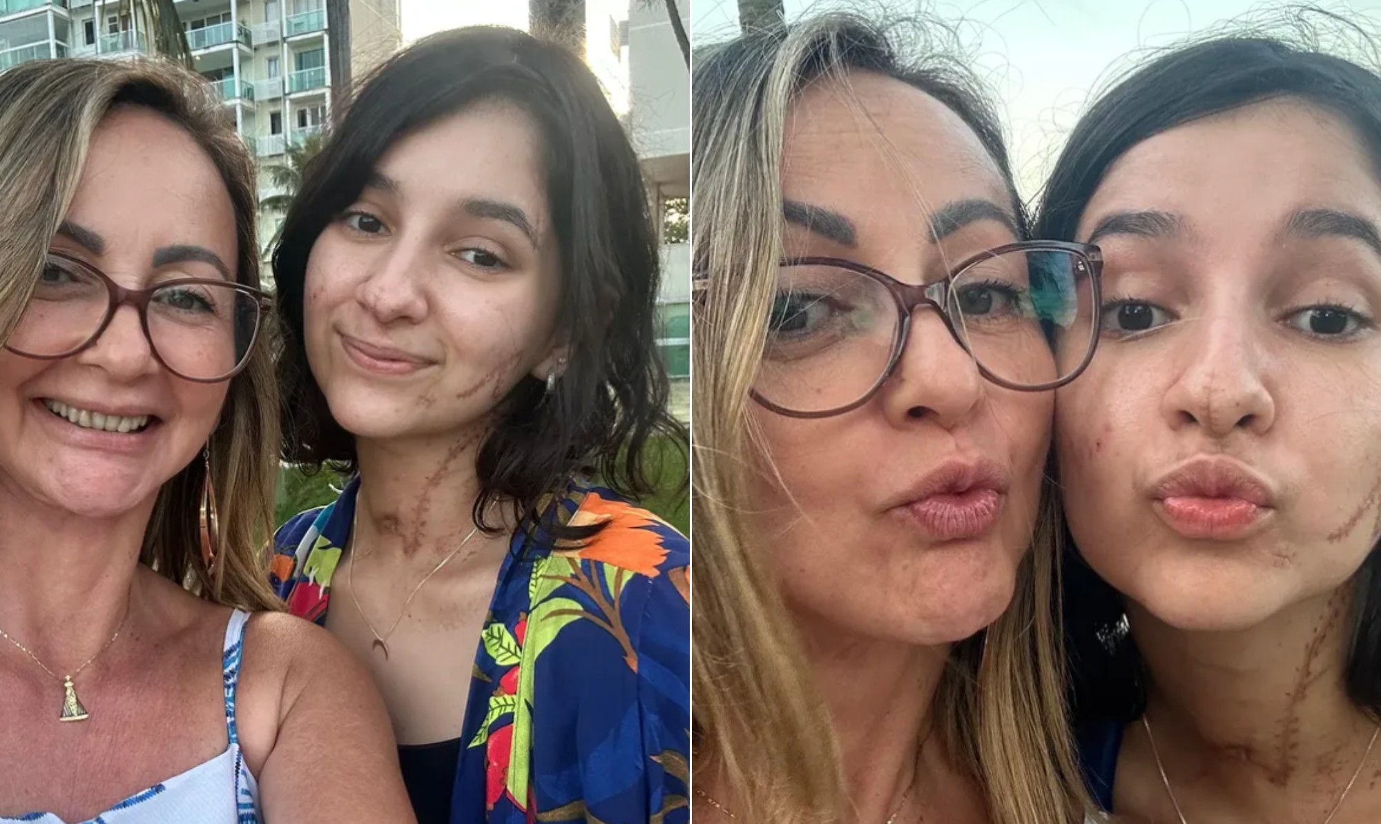 Mãe compartilha primeiro passeio da jovem Alana Anísio, de 20 anos, que ...