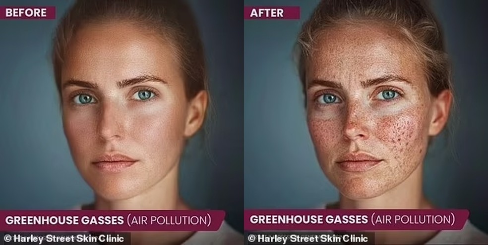 Partículas da poluição também podem provocar danos — Foto: Reprodução