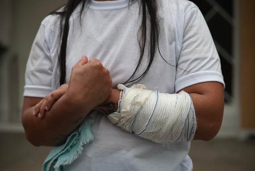 Mulher que foi atingida por tiro de raspão em ação policial na Baixada Santista na terça-feira (5): caso terminou com criança de 4 anos e um adolescente de 17 anos mortos