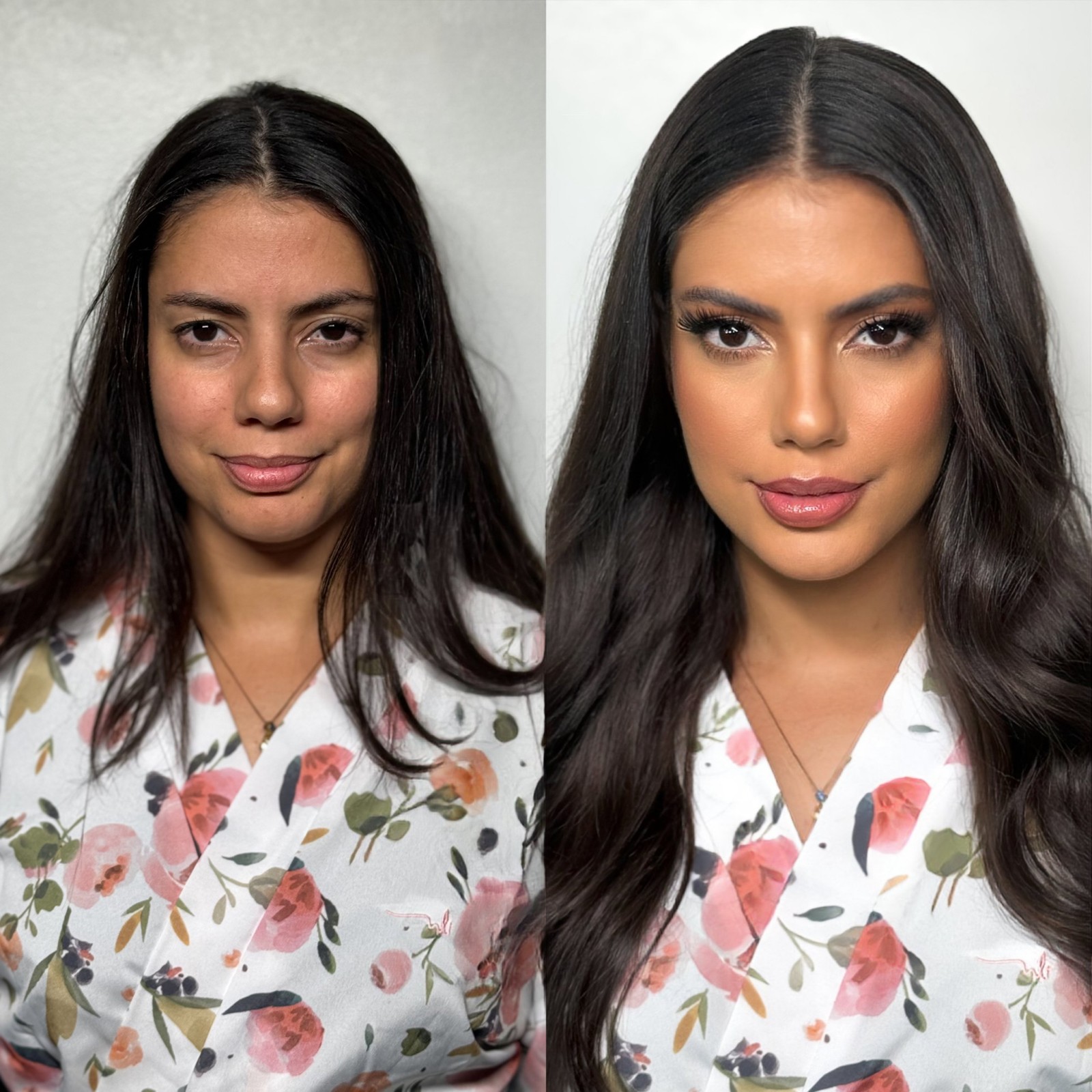 Fernanda fez tratamentos estéticos no rosto após deixar o programa