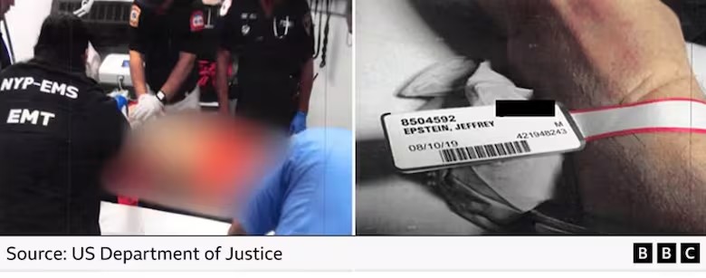 Lesões no pescoço, mandíbula amarrada e possível homicídio: o que revelam fotos do cadáver e documentos inéditos sobre a morte de Jeffrey Epstein?