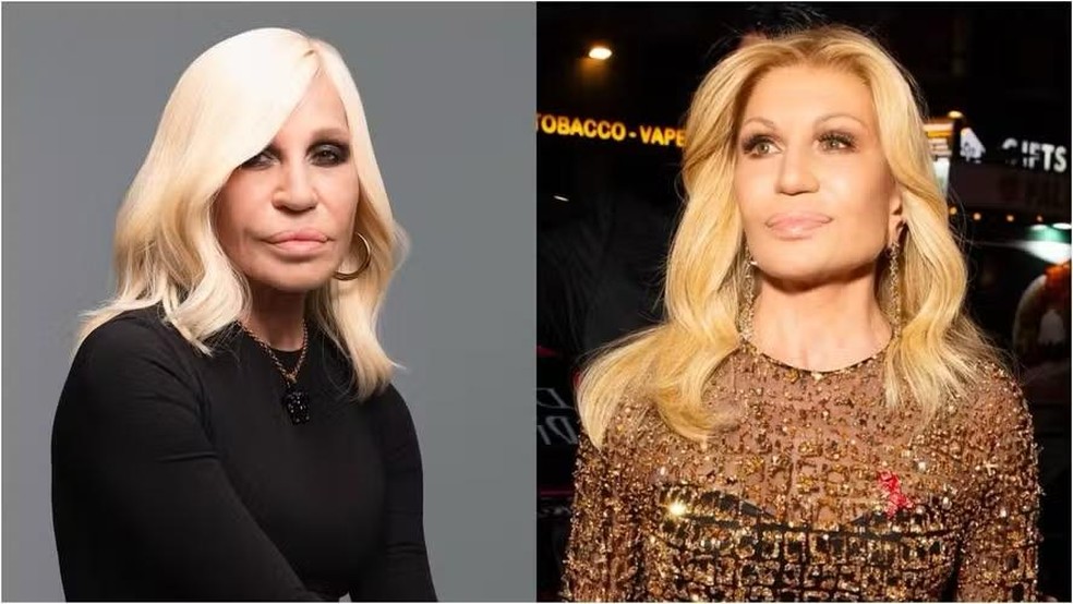Donatella Versace surpreende com rosto mais natural e harmonioso após retirar preenchimentos antigos e aderir a procedimentos modernos de lifting facial — Foto: Getty Images/@donatella_versace