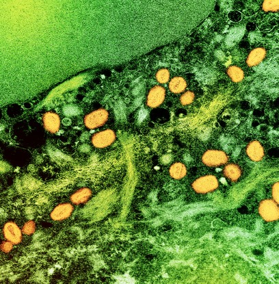 Micrografia eletrônica de transmissão colorida de partículas do vírus da varíola dos macacos (amarelo) encontradas dentro de uma célula infectada (verde), cultivadas em laboratório.
