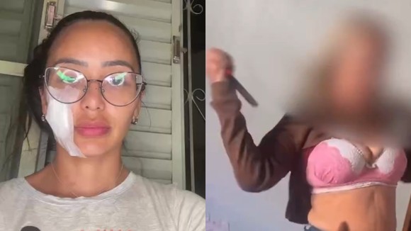 Ex-bailarina do Faustão é esfaqueada pela própria mãe em Minas Gerais