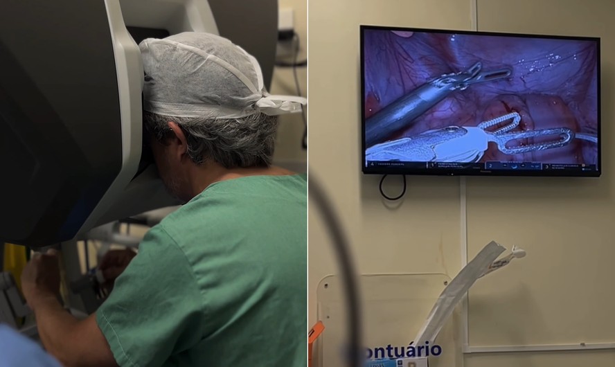 Clínica realiza 1ª cirurgia de redesignação sexual com técnica robótica ...