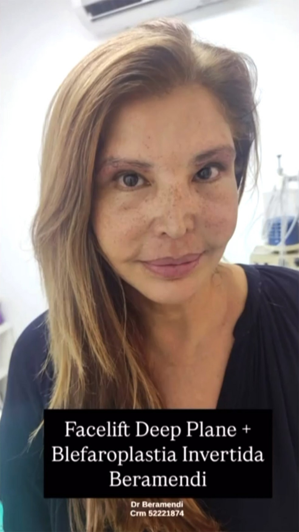 Roberta Close — Foto: Reprodução Instagram