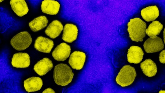 Varíola dos macacos: presença do vírus no sêmen 'não é rara nem aleatória', revela estudo italiano