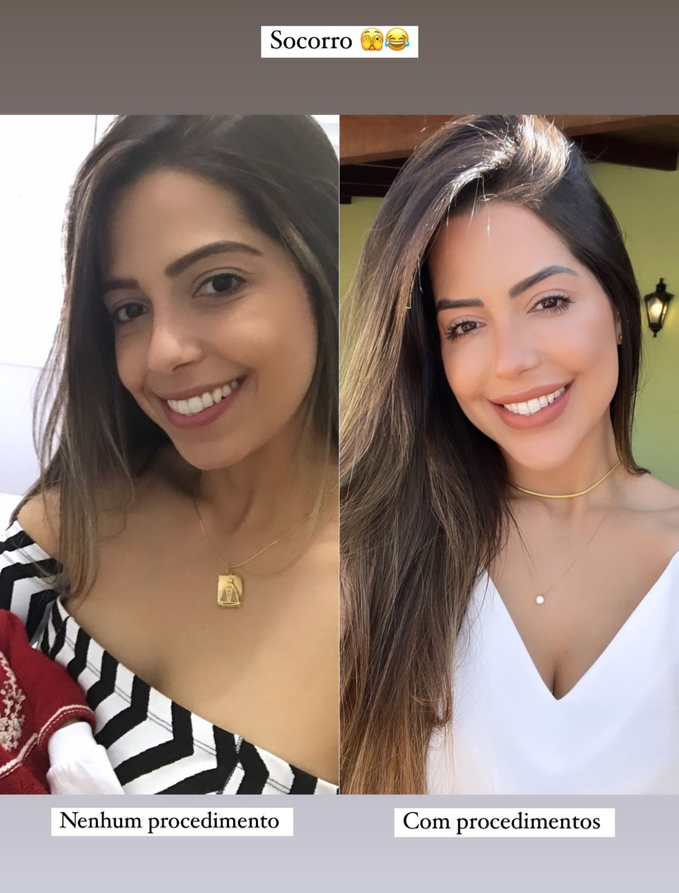Antes e depois de Laís Cladas — Foto: Reprodução/Instagram