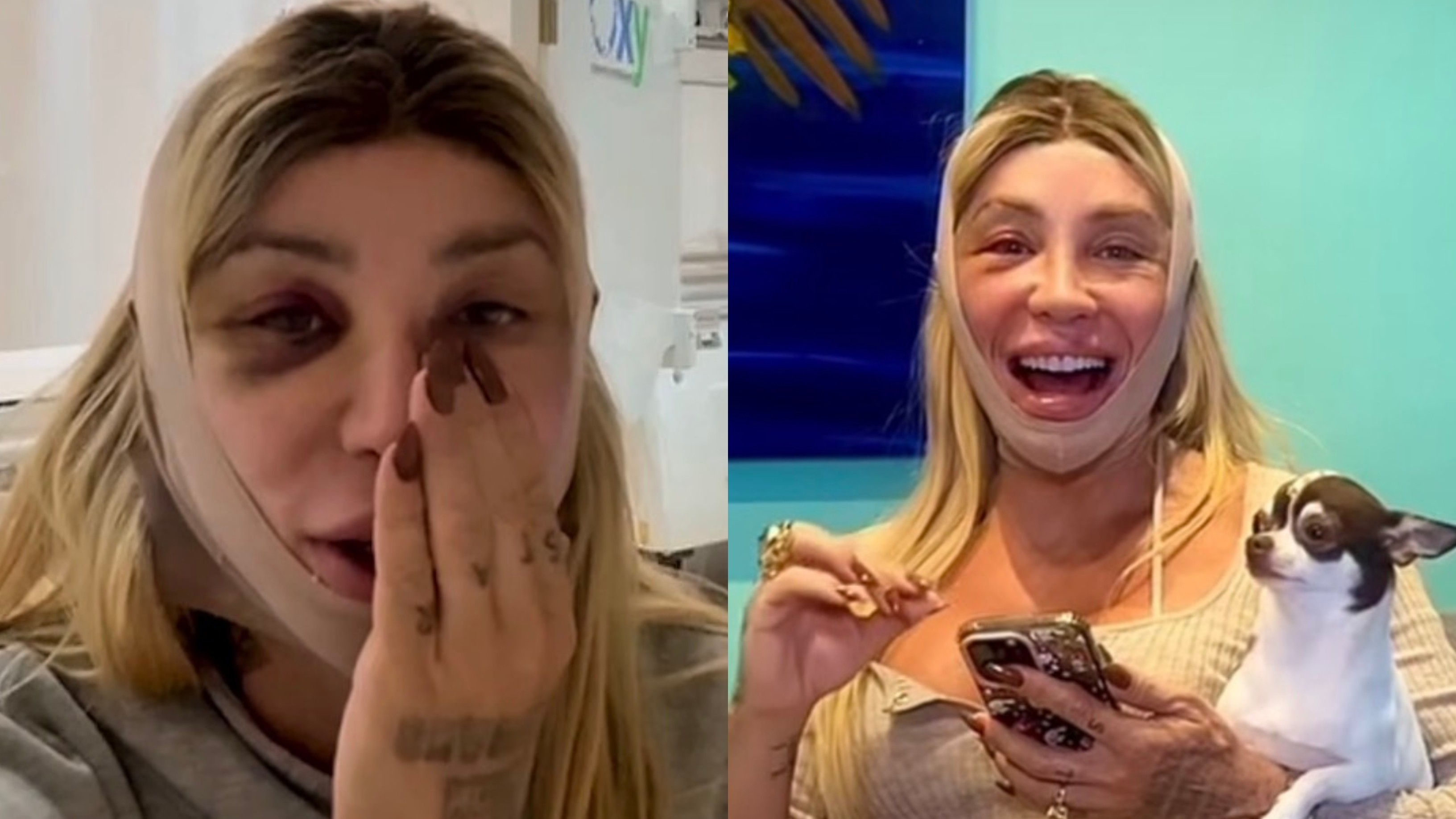 Após cirurgia na mandíbula , Maya Massafera passa por lifting facial ; entenda o procedimento e saiba quanto custa