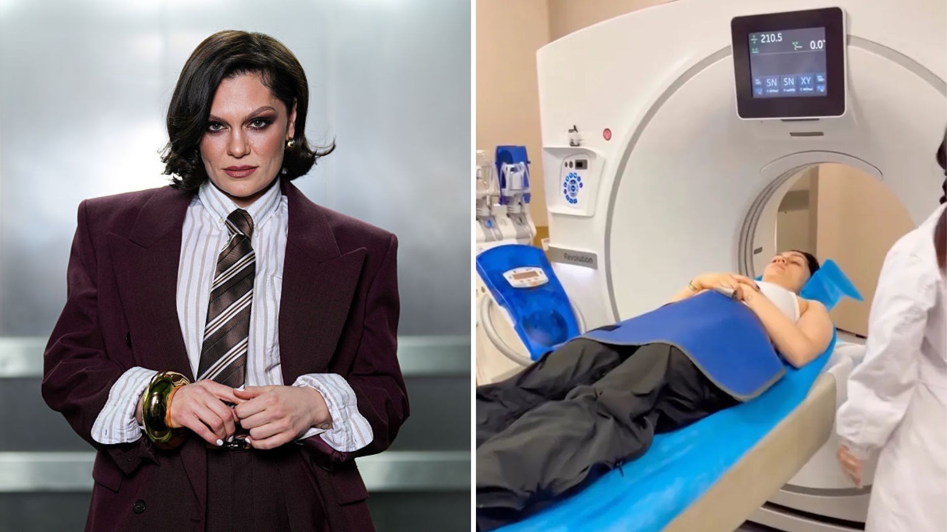 Jessie J é levada ao hospital após acidente e preocupa fãs: 'Achei que tinha quebrado o pescoço'