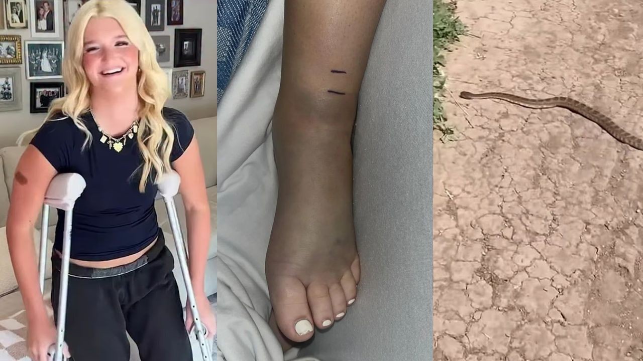 Adolescente fica em estado grave após ser picada por cascavel durante passeio de bicicleta nos EUA