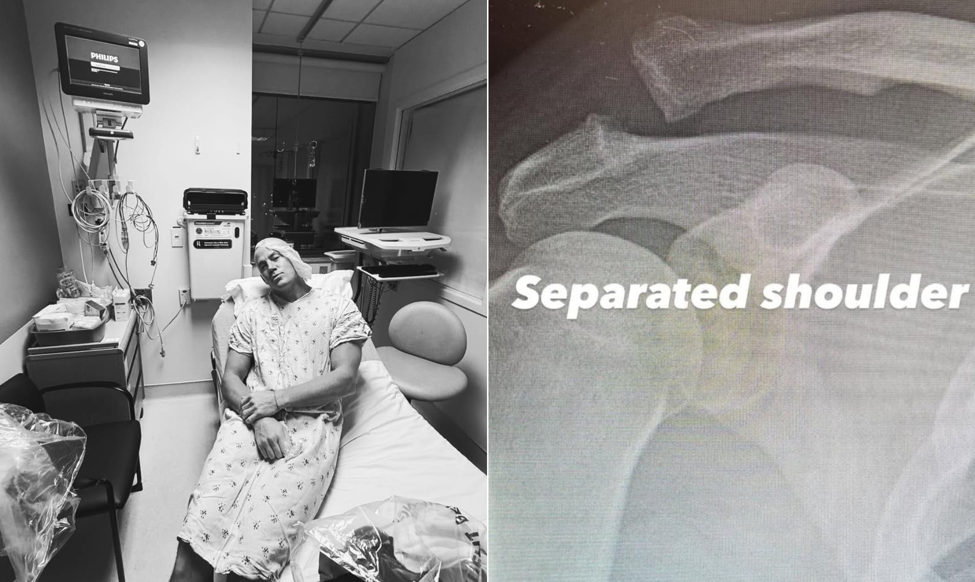 Separa&ccedil;&atilde;o do ombro: entenda a condi&ccedil;&atilde;o que fez o ator Channing Tatum passar por cirurgia; veja fotos