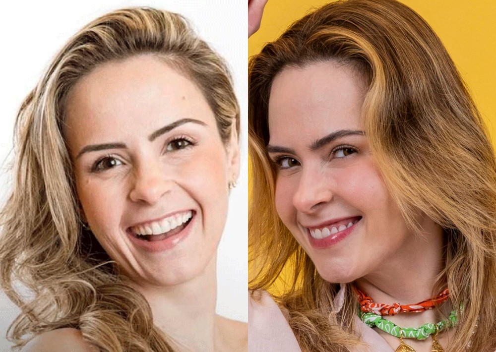 'BBB 26' conheça os procedimentos que Ana Paula Renault faz para