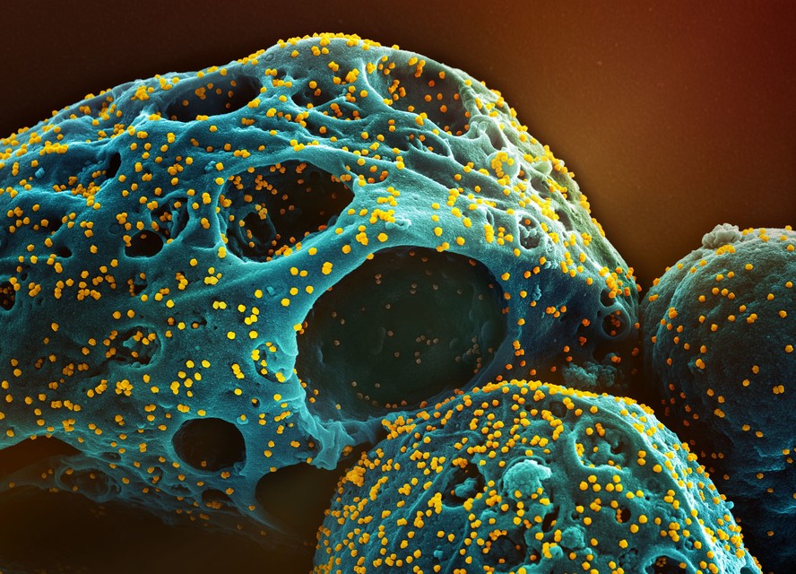Micrografia eletrônica de varredura colorida de uma célula (azul-petróleo) infectada com a cepa Ômicron do SARS-CoV-2 (amarelo), isolada de uma amostra de paciente.