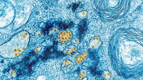 Febre amarela: Cientistas brasileiros e americanos criam tratamento inédito para a doença