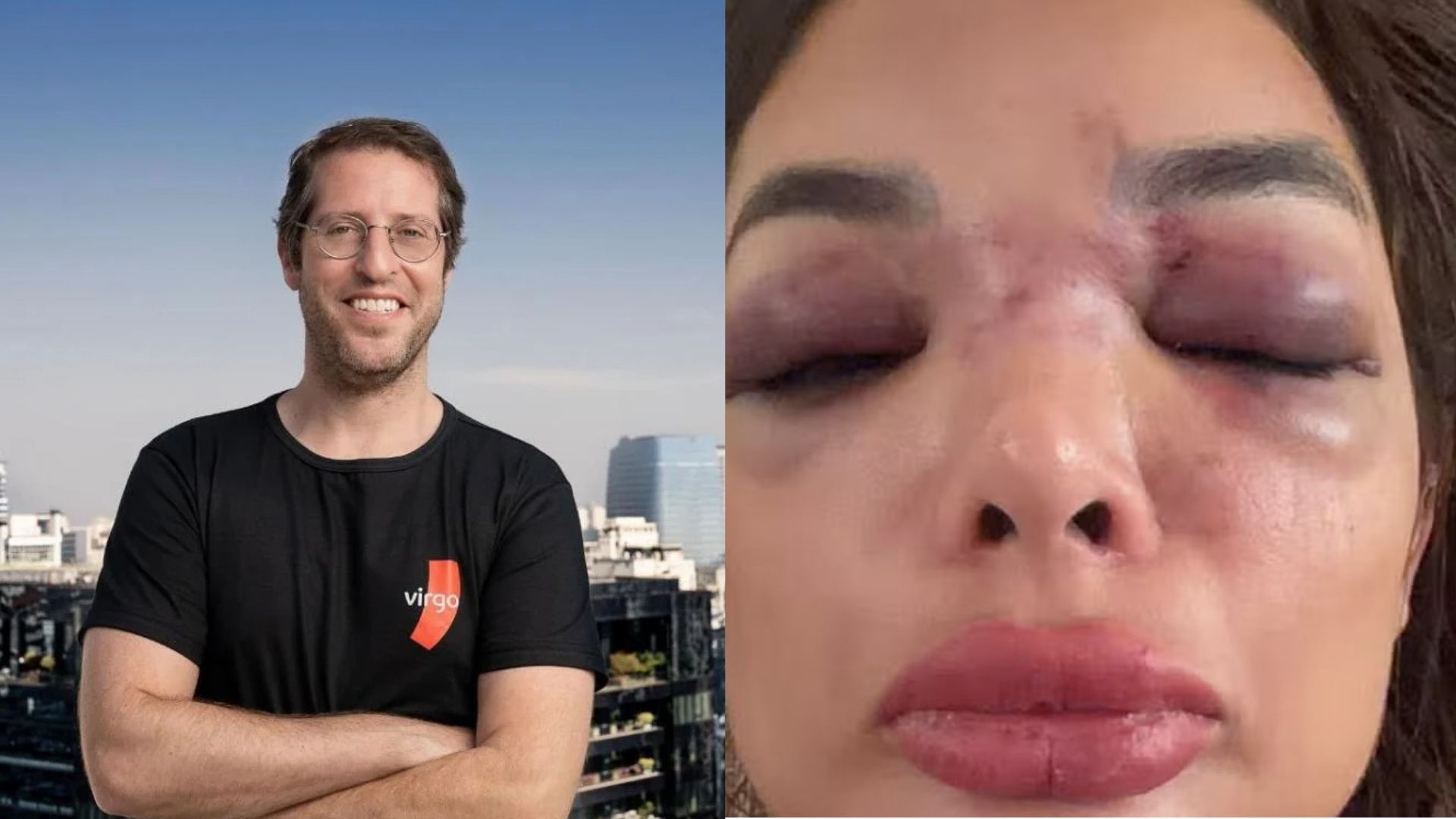 Preso por agredir mulher, empresário da Faria Lima se torna réu por lesão corporal e ameaça