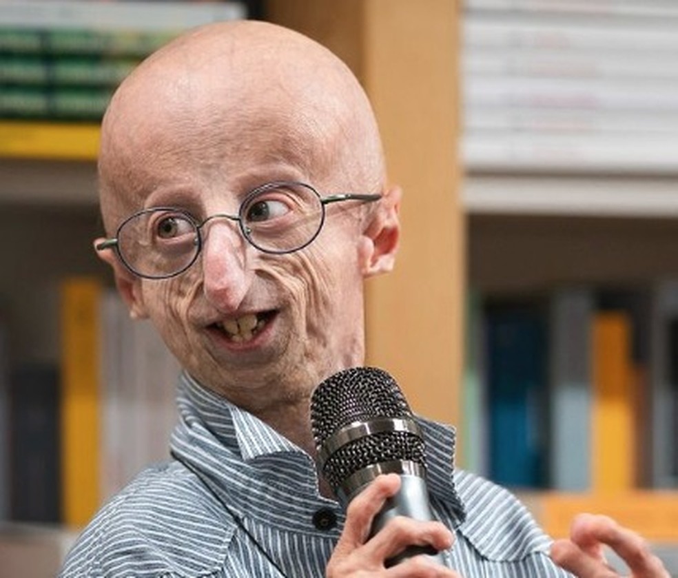 Morre Sammy Basso, pessoa com envelhecimento prematuro mais longeva do mundo, aos 28 anos — Foto: Reprodução/Instagram