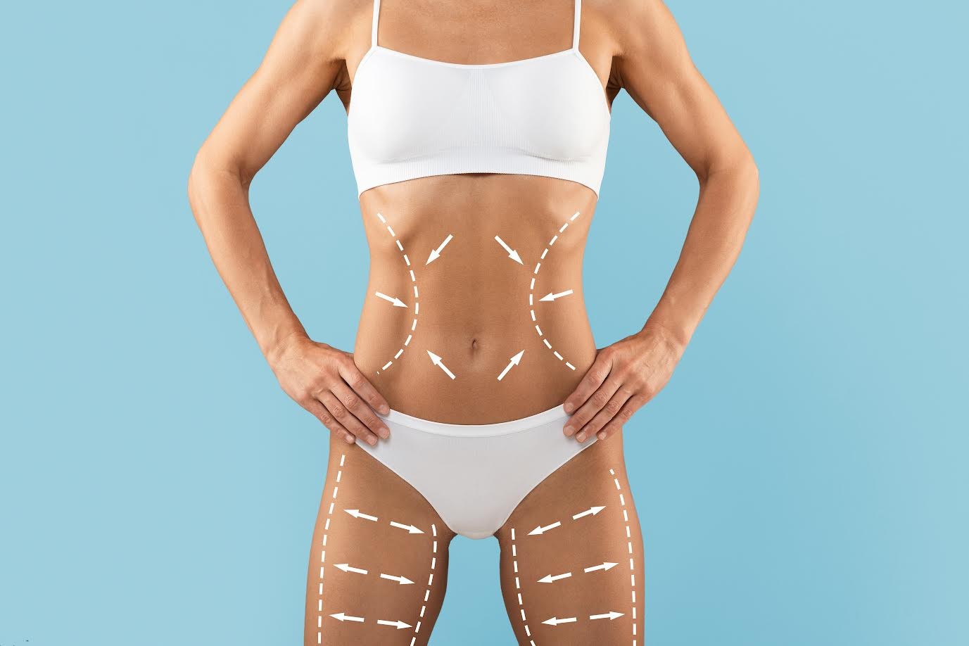 Avanços tecnológicos ampliam resultados da lipoaspiração