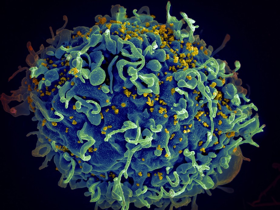 HIV: cientistas anunciam 7&ordm; paciente curado da infec&ccedil;&atilde;o; entenda