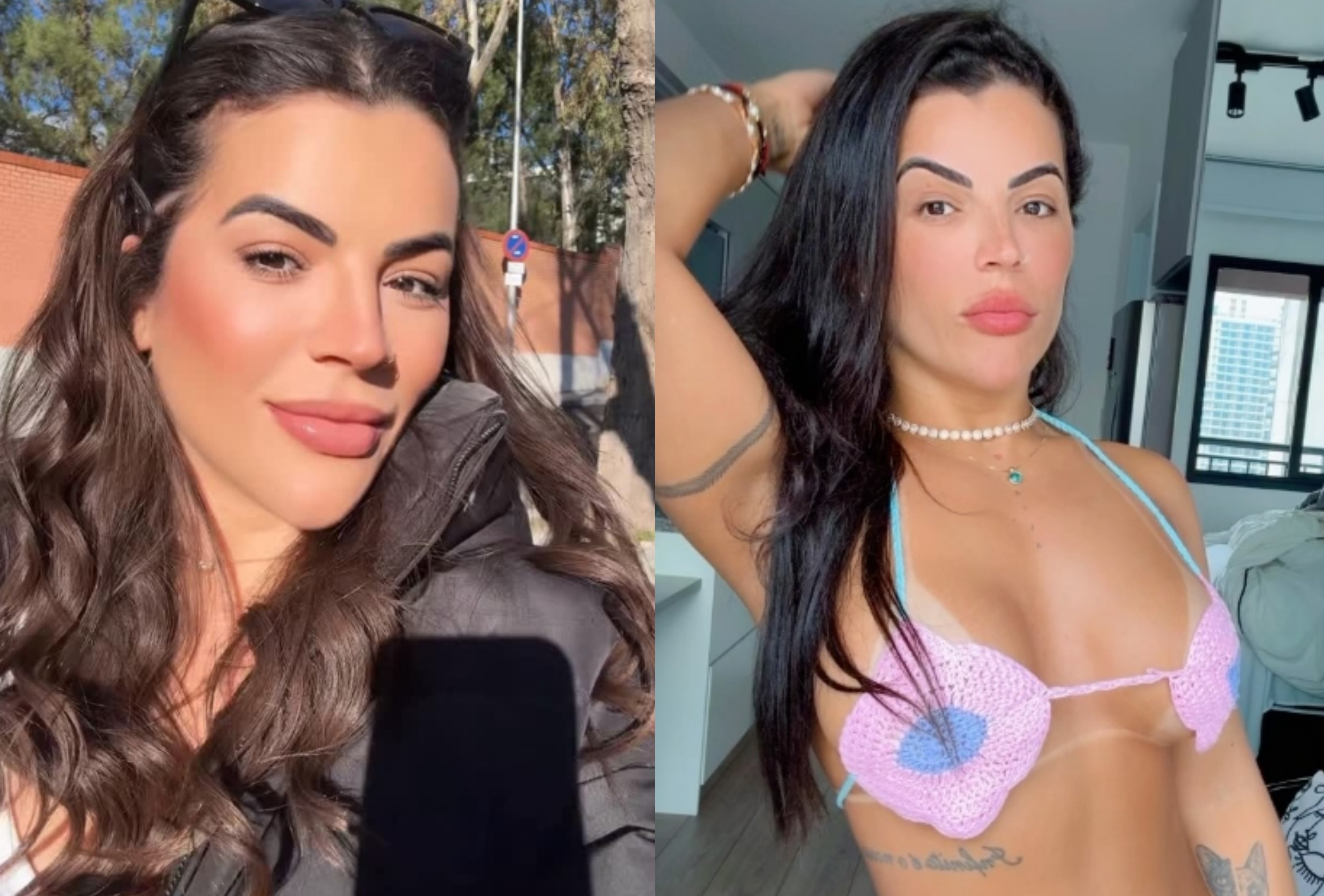 Ex-Miss Bumbum Rosana Ferreira conta porque aplicou botox nas nádegas, e especialistas explicam procedimento