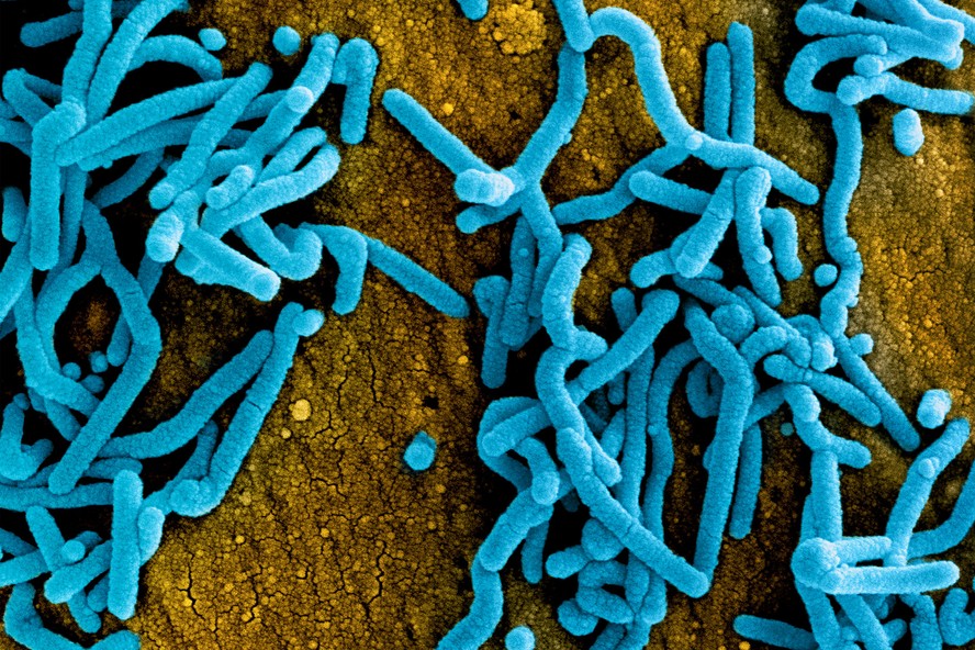 Partículas do vírus Marburg (azul) sobre a superfície de uma célula infectada (laranja).