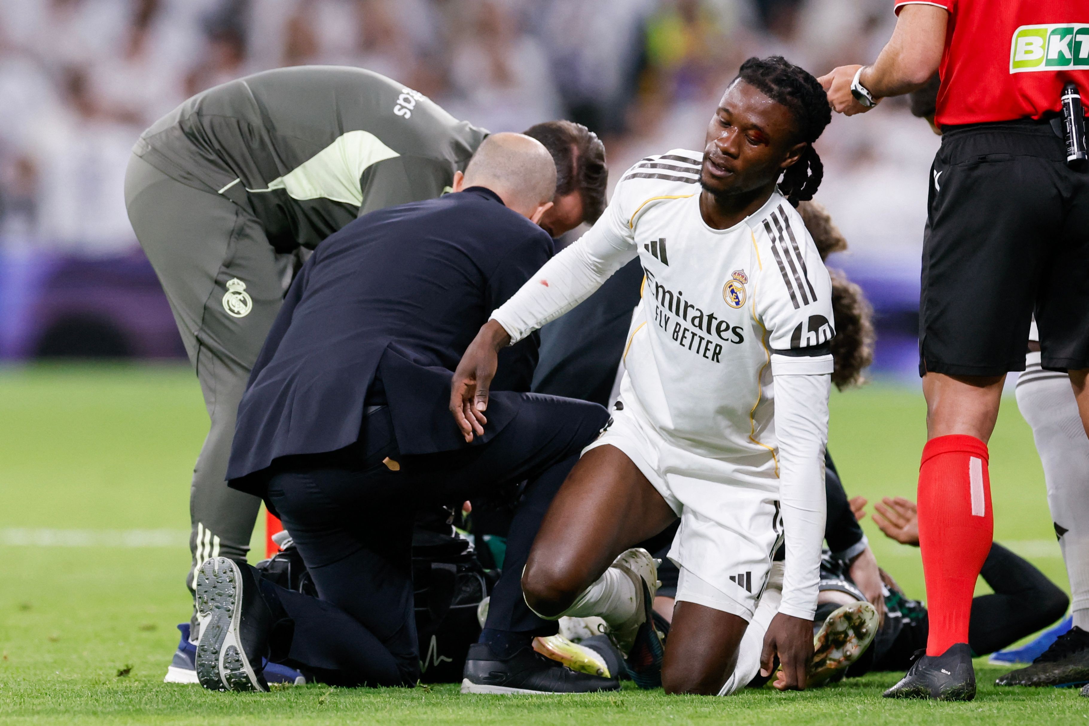 Além de Mbappé, Real Madrid também avaliou perna errada em lesão de Camavinga, diz jornal