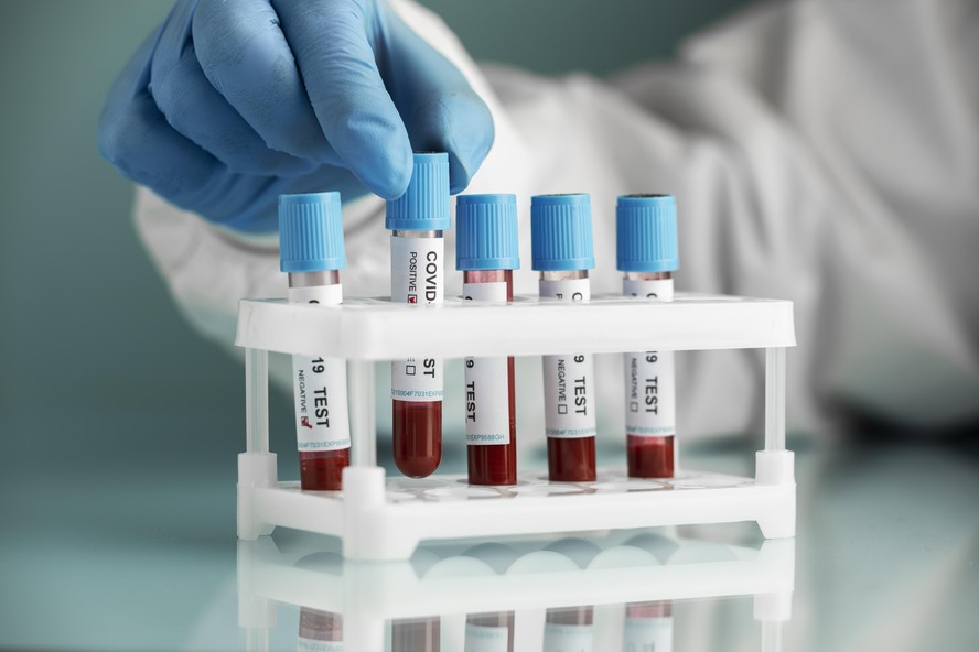 Amostras de banco de sangue podem mostrar evolução de epidemias, mostra estudo.