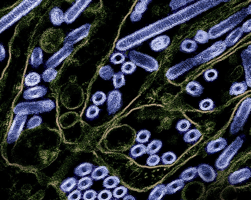 Partículas do vírus da influenza aviária A H5N1 (roxo), cultivadas em células epiteliais. — Foto: CDC / NIAID