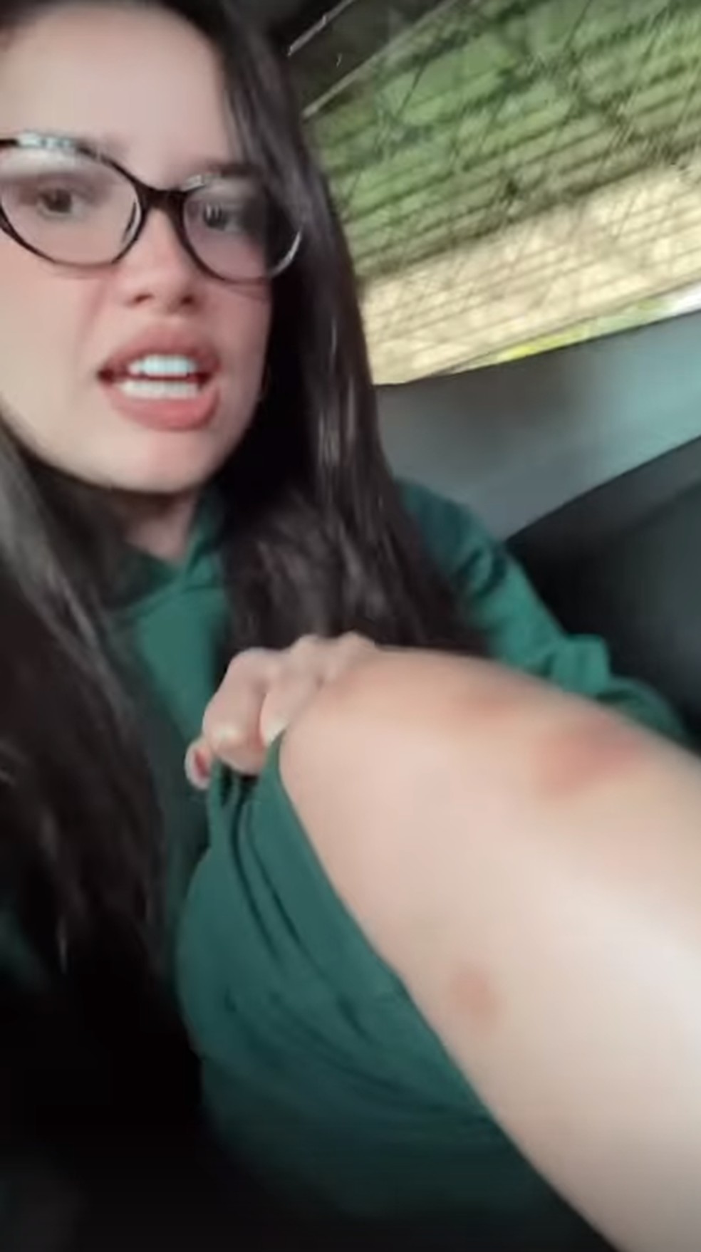 Juliette mostra hematomas após fim de semana com família e amigos
