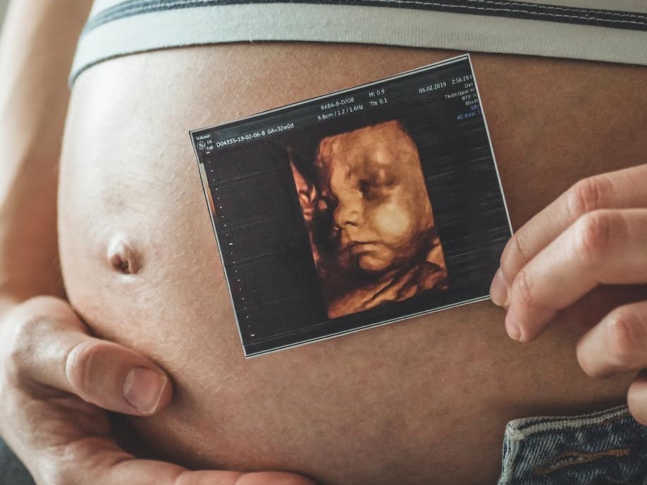 Ultrassonografia obstétrica avança no diagnóstico pré-na