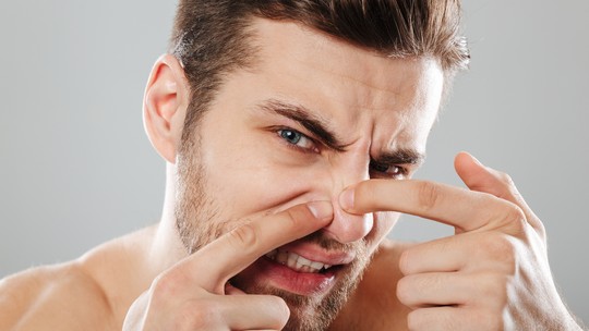 Espinha no nariz? Médico explica por que você nunca deve estourar