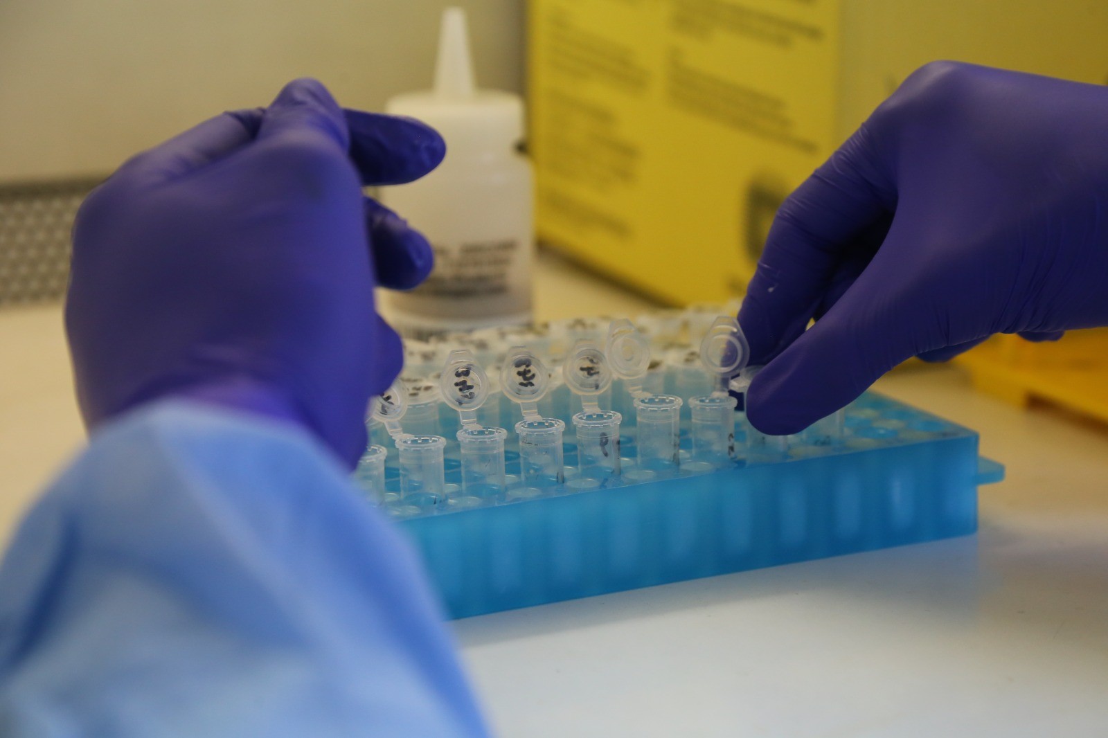 Saiba como acontece a transmissão e as melhores formas de se prevenir da Mpox