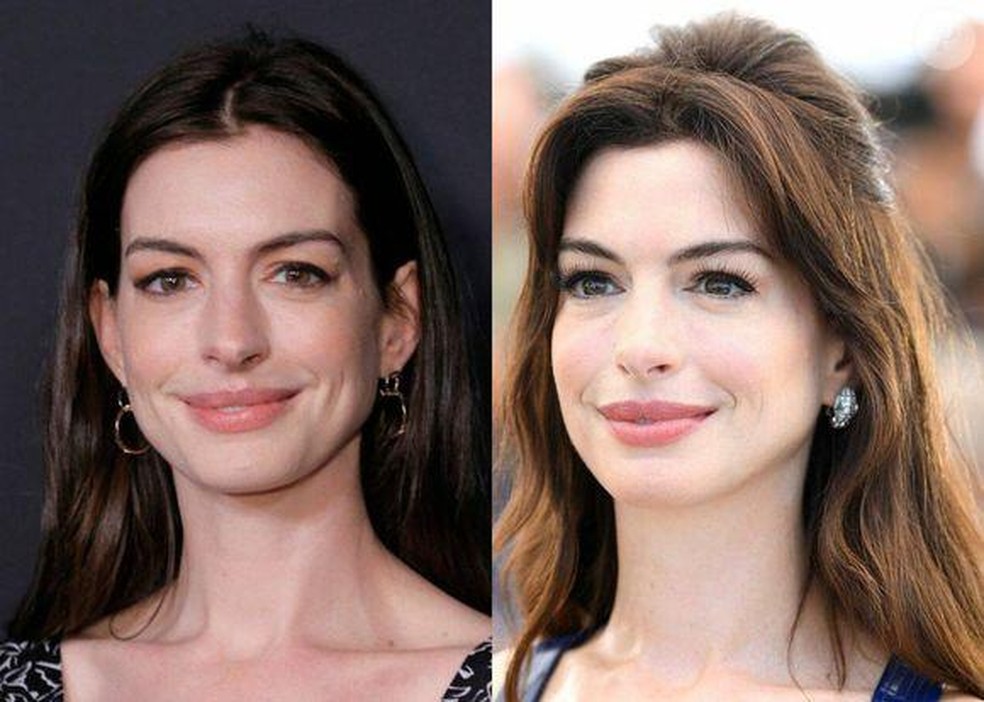 Anne Hathaway exibe pele luminosa e aparência jovial, resultado de técnicas discretas de lifting e harmonização que mantêm seus traços originais — Foto: Getty Images/@annehathaway