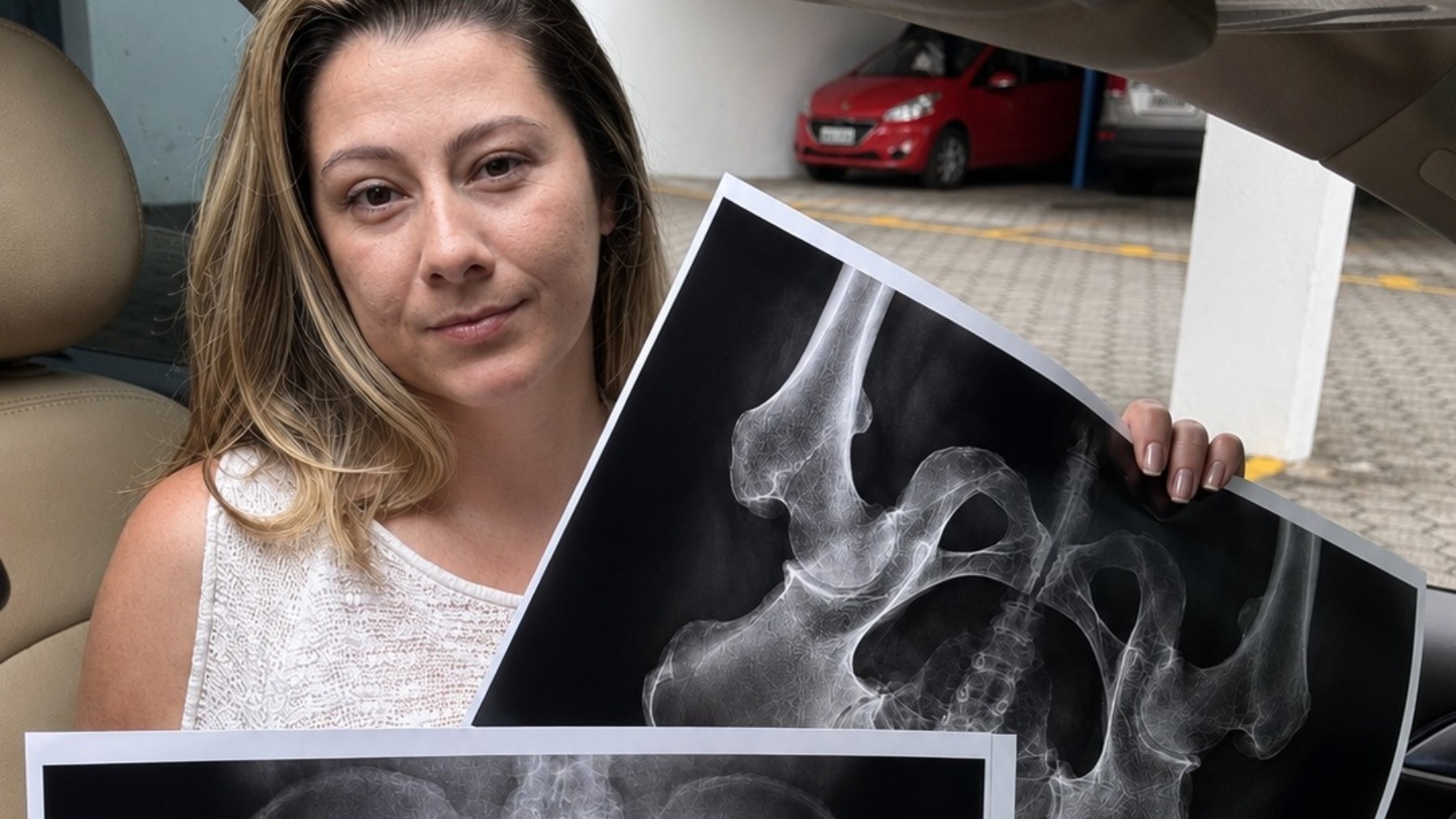 Influenciadora abre caixa postal para fãs e recebe radiografias íntimas com pedido inusitado