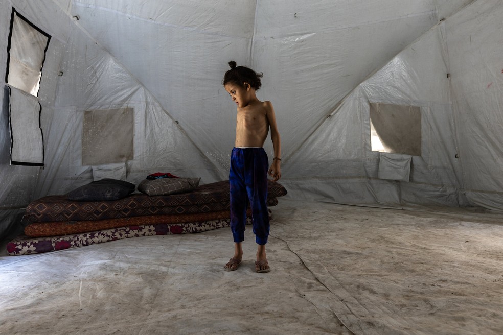 Criança desnutrida em Gaza — Foto: Saher Alghorra / The New York Times
