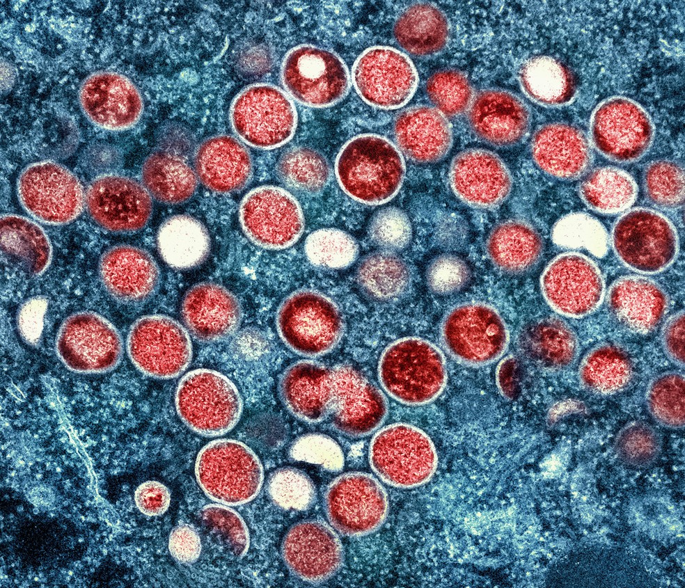 Micrografia eletrônica de transmissão colorida de partículas do vírus da varíola do macaco (vermelho) cultivadas e purificadas a partir de cultura de células — Foto: NIAID/ Divulgação