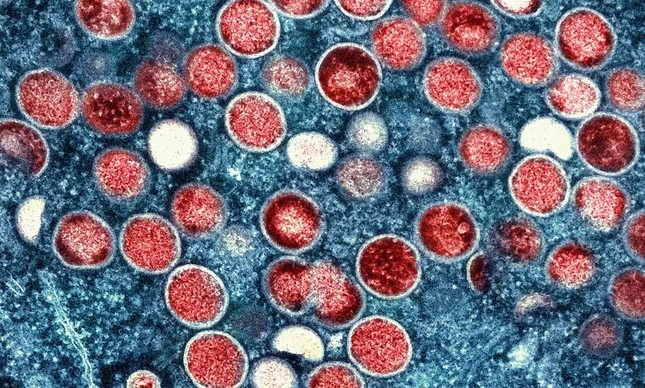 Micrografia eletrônica do vírus da varíola do macaco (vermelho) — Foto: Não informado