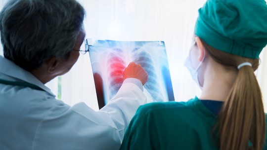 Câncer de pulmão: nova terapia reduz ou controla tumor metastático em 70% dos pacientes