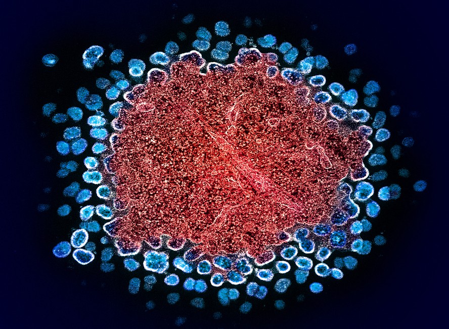 Partículas do vírus HIV-1 (azul) replicando-se a partir de um segmento de uma célula infectada (vermelho).