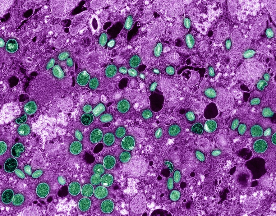 Vírus da mpox (verde) infectando células (em magenta).