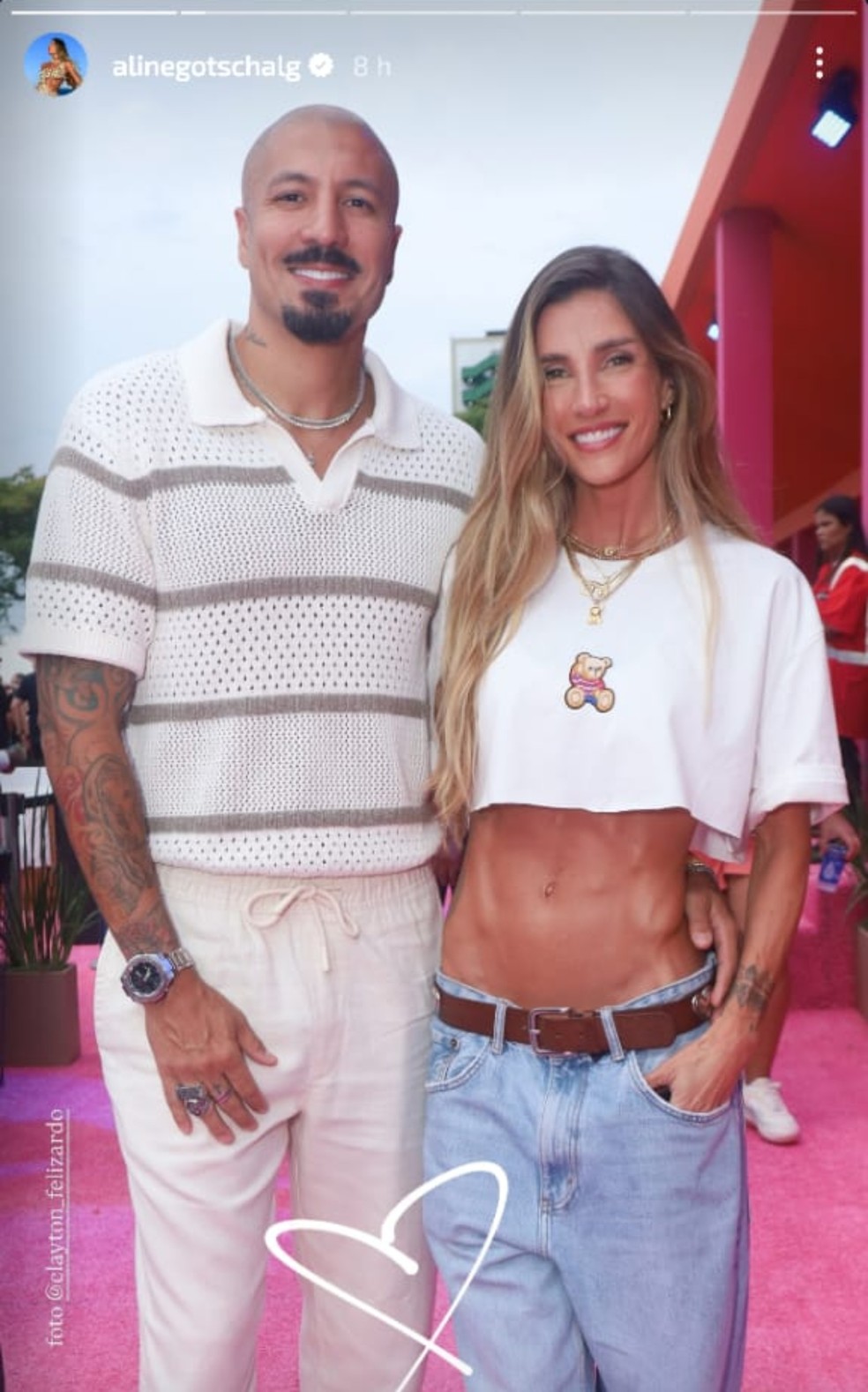 Aline Gotschalg respondeu críticas sobre mudanças no rosto e gerou repercussão — Foto: Reprodução Instagram
