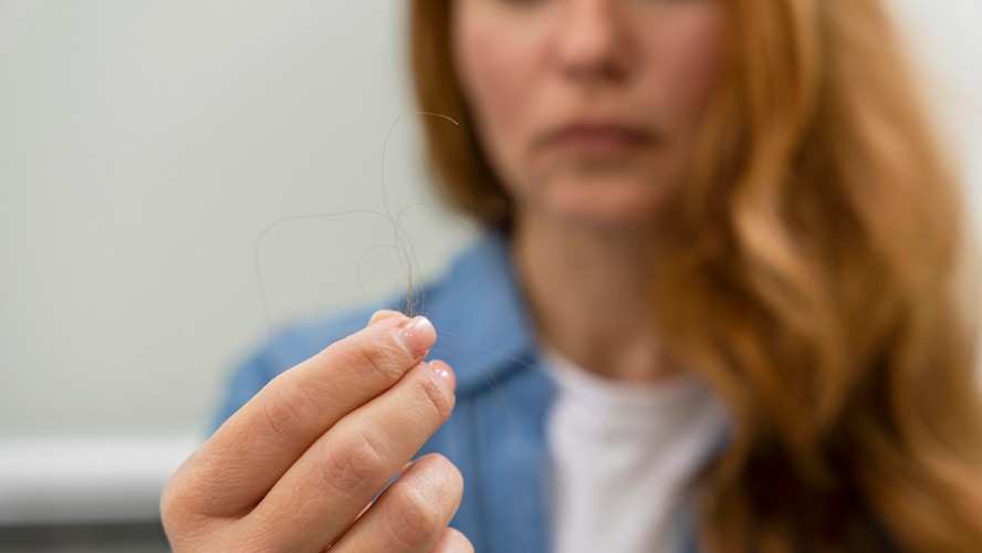 Queda de cabelo após canetas emagrecedoras faz crescer procura por megahair