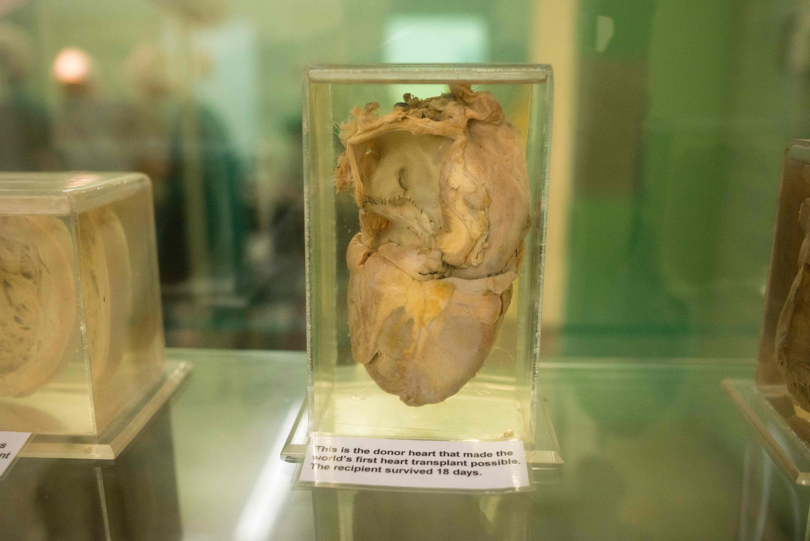 Coração do doador original usado no primeiro transplante de coração do mundo em exibição no museu Heart of Cape Town, no Hospital Groote Schuur na Cidade do Cabo — Foto: Rodger Bosch / AFP