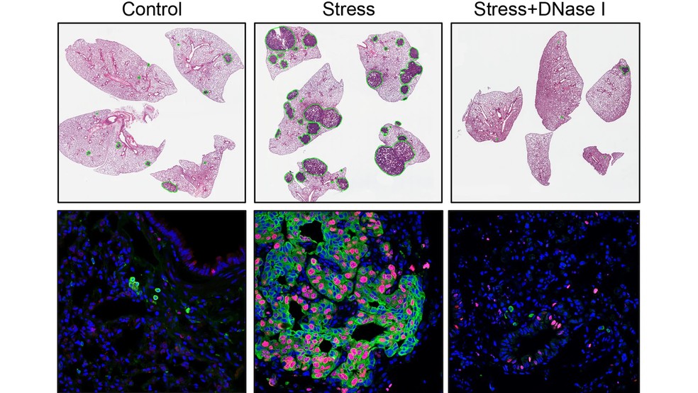 Câncer: estudo aponta que estresse influencia no tamanho de tumores; entenda como — Foto: Cold Spring Harbor Laboratory