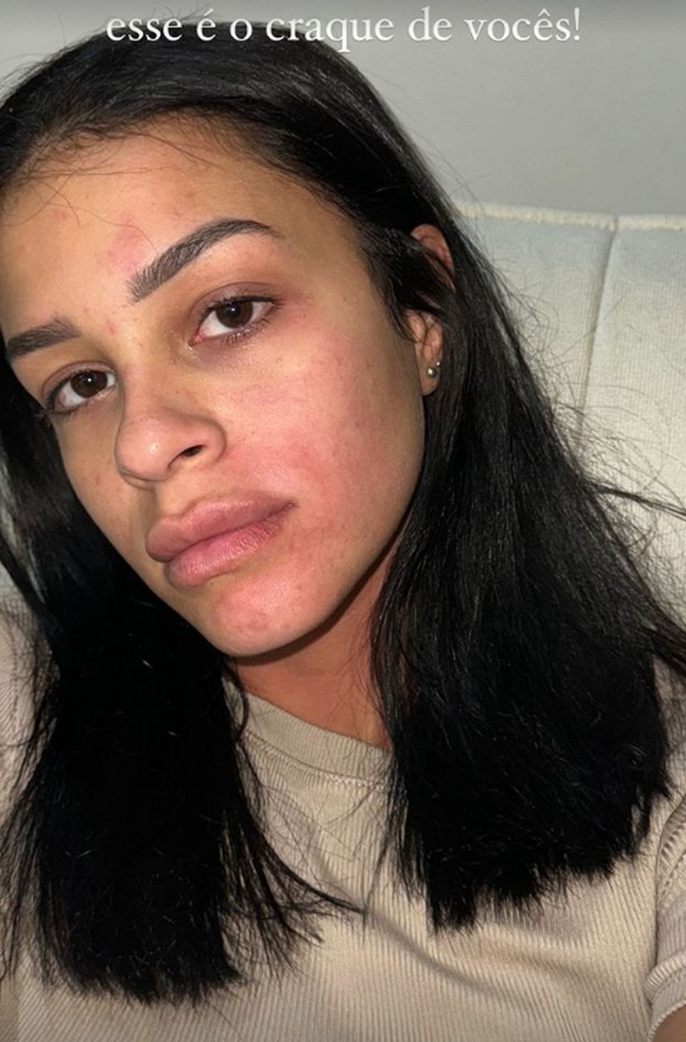 Isabella publicou fotos do rosto machucado nas redes sociais — Foto: Reprodução